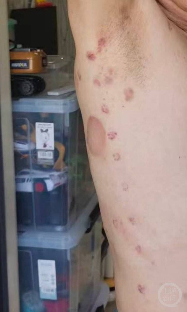 男子称在理发店充值430多万元做灌肠针刺排毒后不适退费难，当地回应