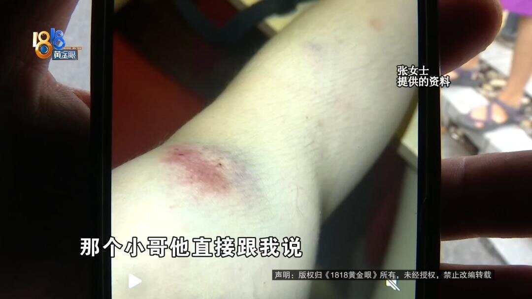 女子下班回家被外卖骑手撞伤 外卖小哥:我只有三块钱